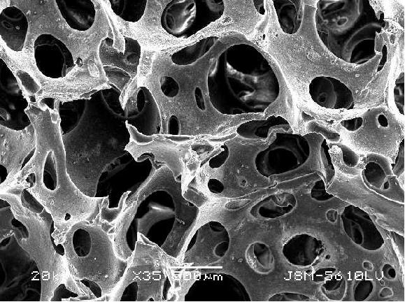 Succinyl-chitosan/polyvinyl alcohol composite sponge and preparation method thereof