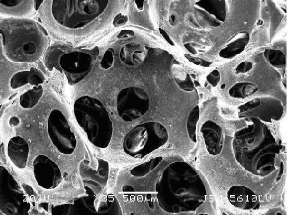 Succinyl-chitosan/polyvinyl alcohol composite sponge and preparation method thereof