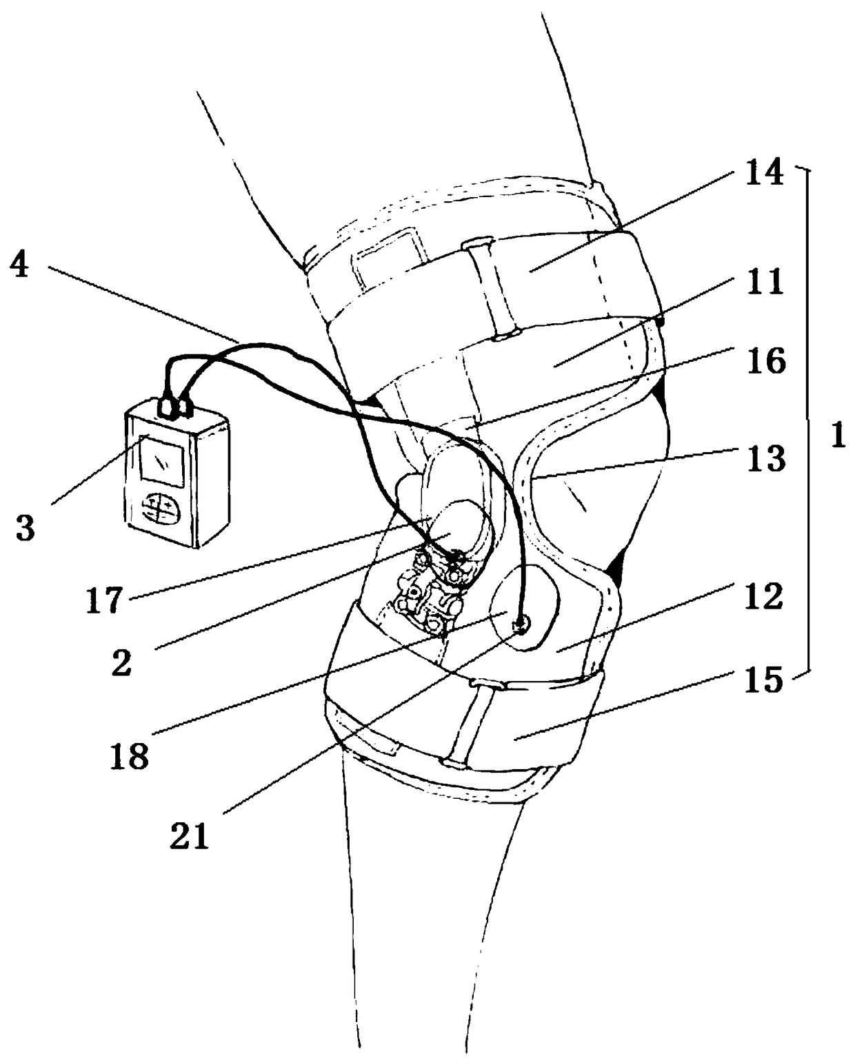 Acupoint-stimulated knee orthosis