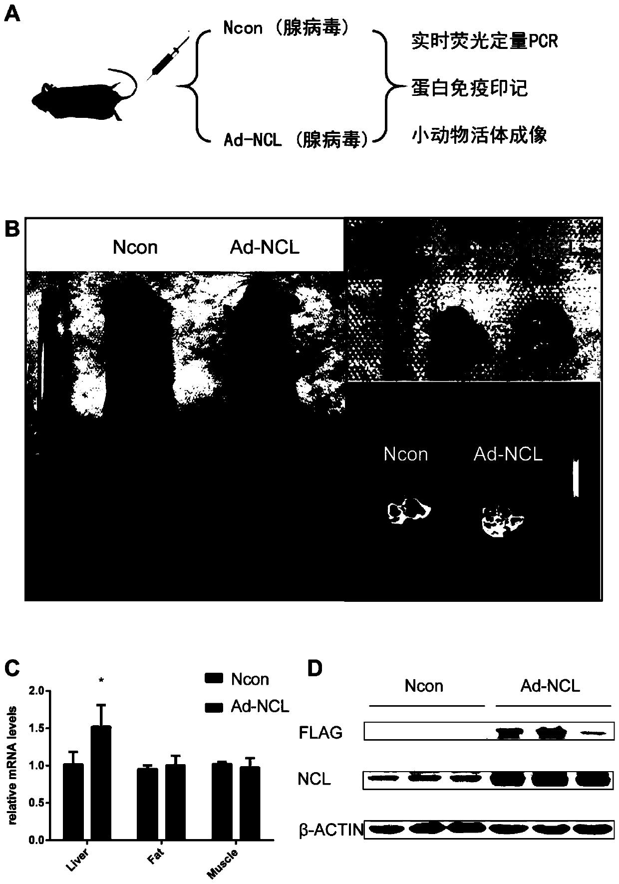 Application of nucleolin in preparation of drugs for improving glucose metabolism disorders