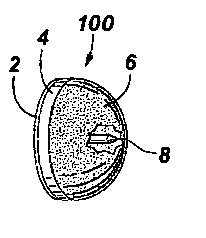 Attachment apparatus and methods