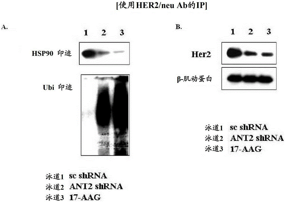 Method for treating breast cancer by reducing expression of adenine nucleotide transporter 2 mRNA