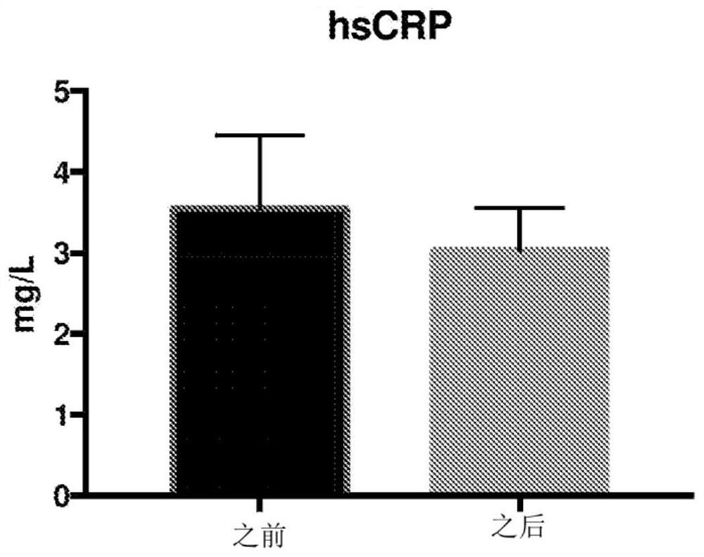 Bacteriophage compositions and kits and related methods