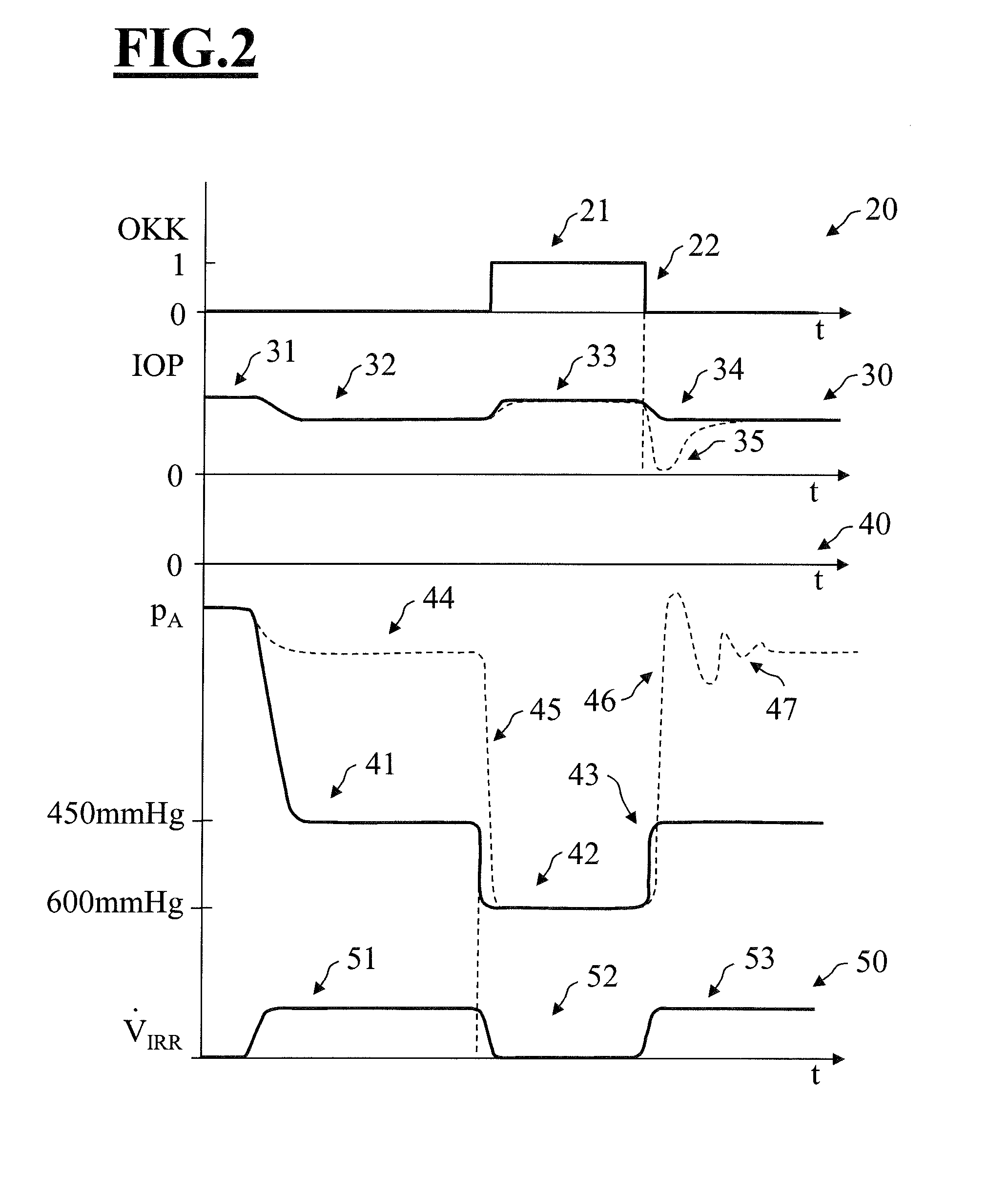 Ophthalmic surgical apparatus for phacoemulsification