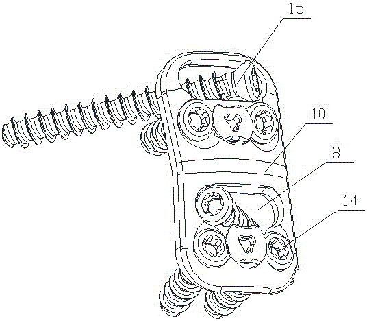 Guiding device for anterior cervical internal fixation