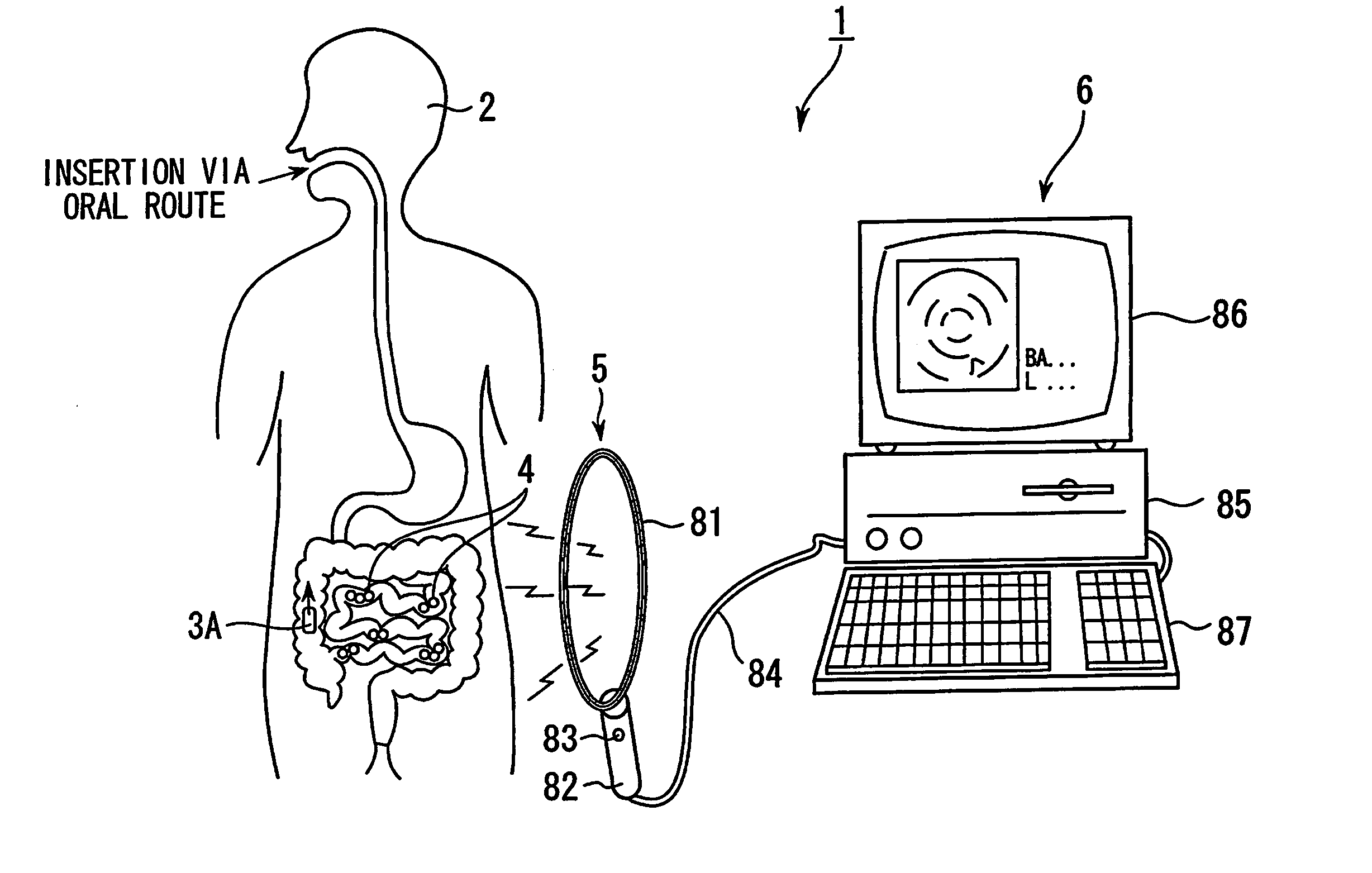 In-vivo information acquisition apparatus and in-vivo information acquisition apparatus system