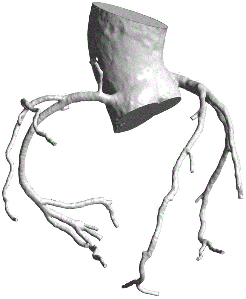 Construction method of three-dimensional coronary artery analysis model and system thereof