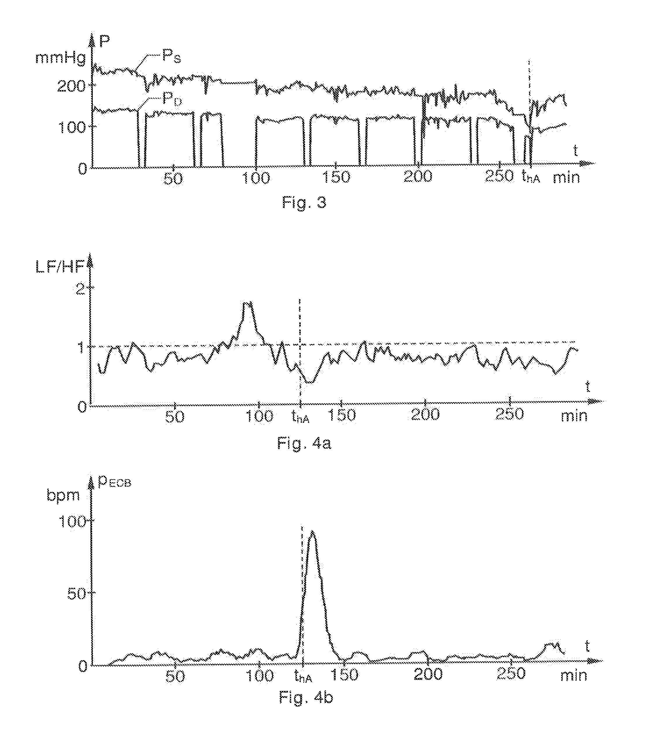 Detection of drastic blood pressure changes