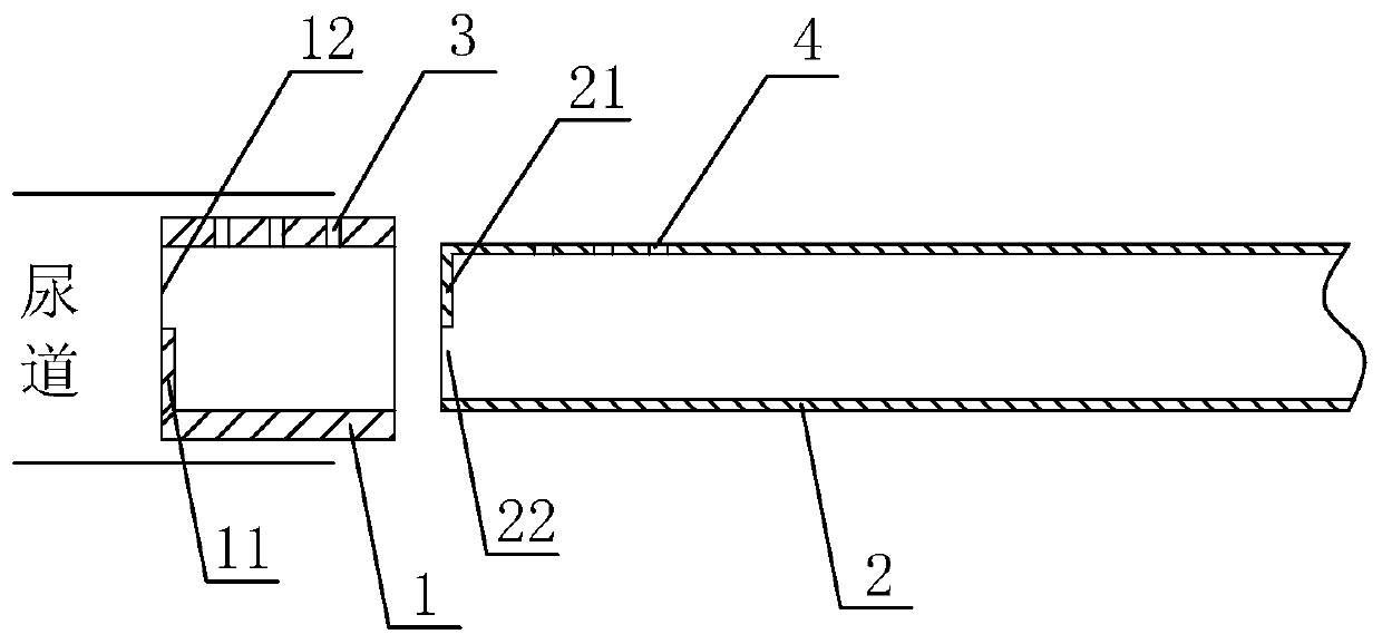 Novel urinary catheter and joint and cleaning method thereof