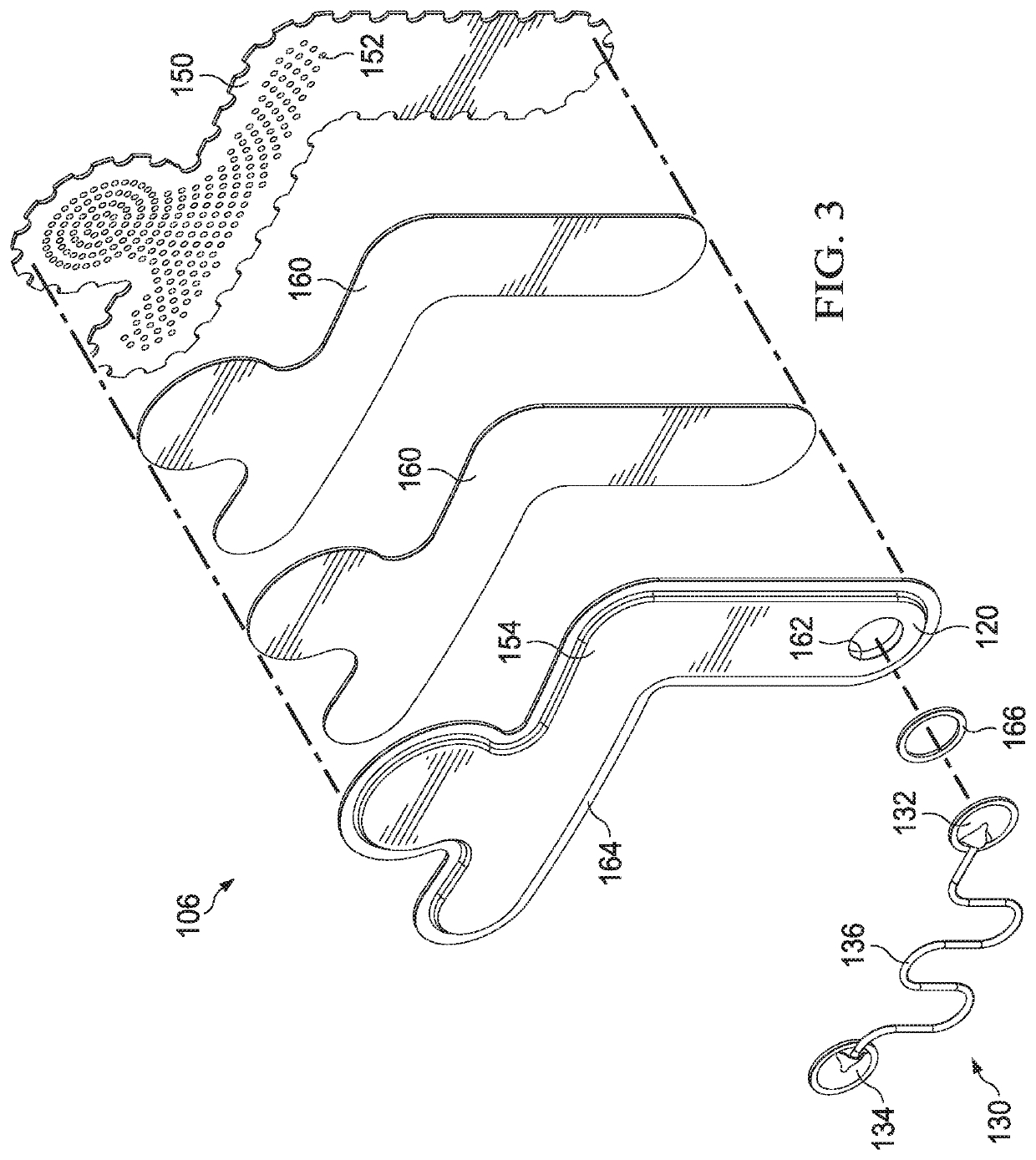 An absorbent negative-pressure dressing system for use with post-surgical breast wounds