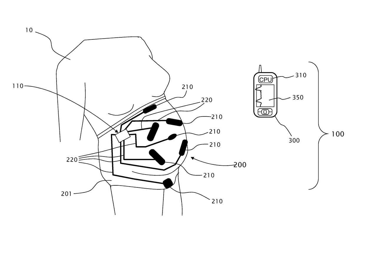 Wearable fetal monitoring system having textile electrodes