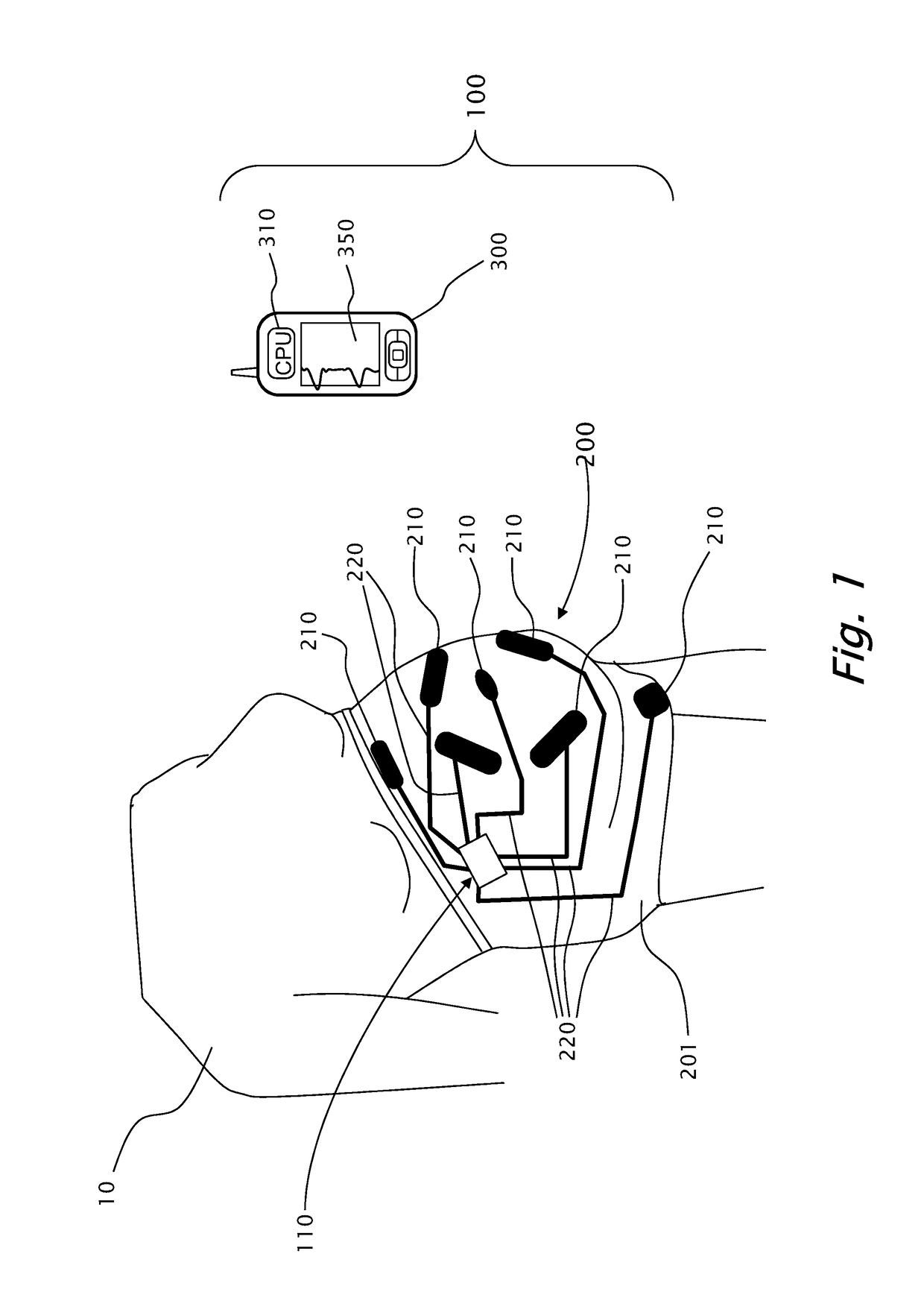 Wearable fetal monitoring system having textile electrodes