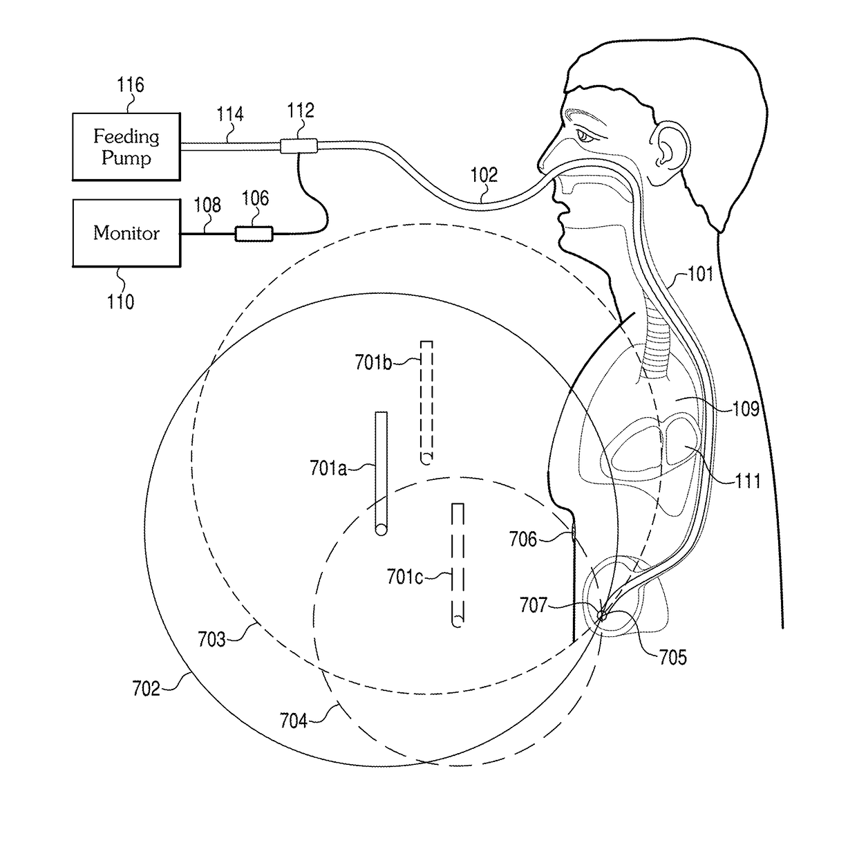 Methods and apparatus for guiding medical care based on sensor data from the gastrointestinal tract