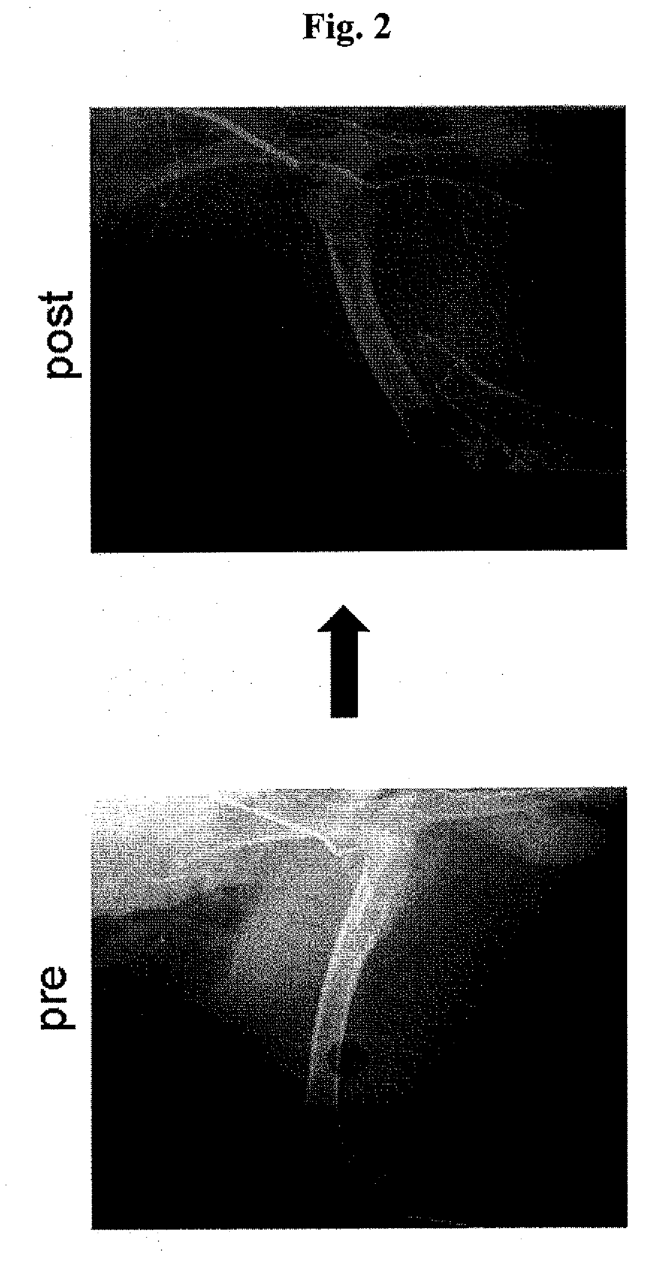 Ischemia therapeutic agent