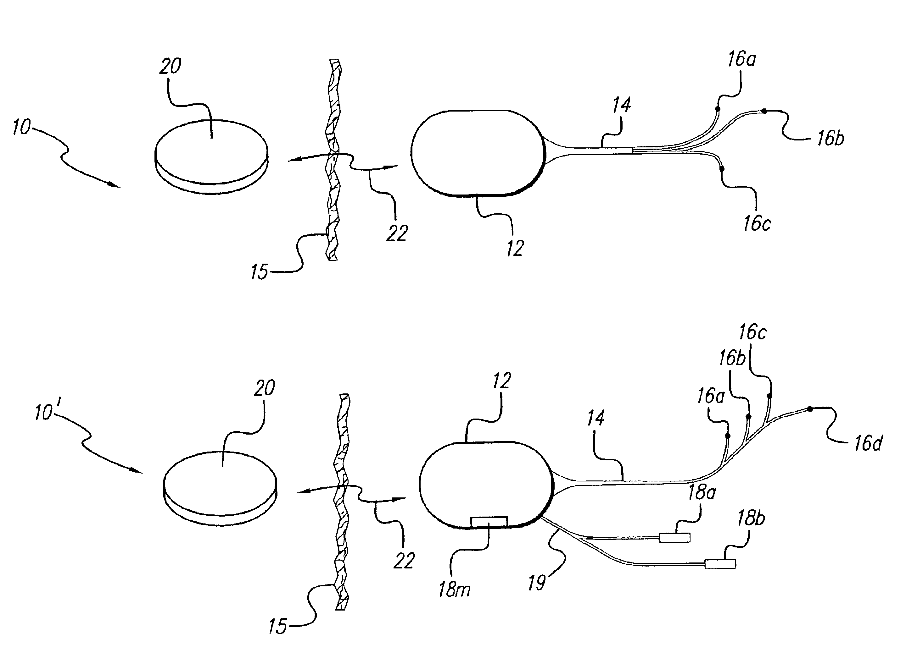 Programmable implantable pump with accessory reservoirs and multiple independent lumen catheter