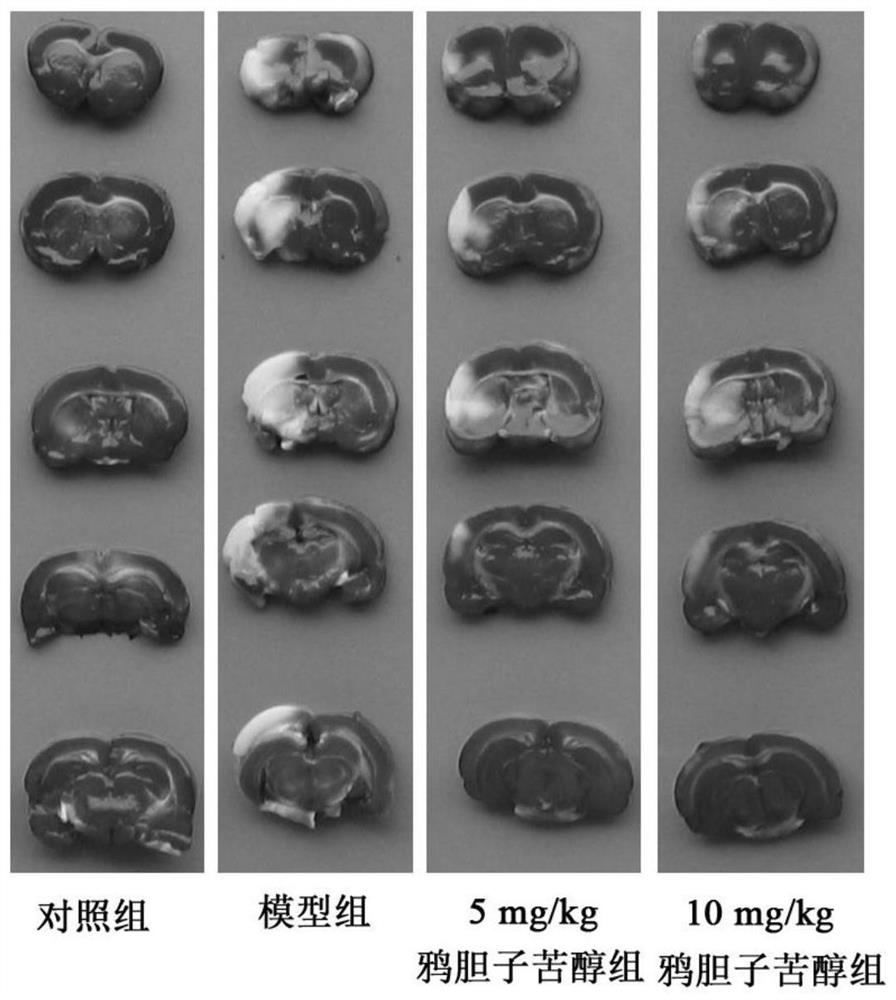 Application of brusatol to preparation of medicine for treating cerebral arterial thrombosis