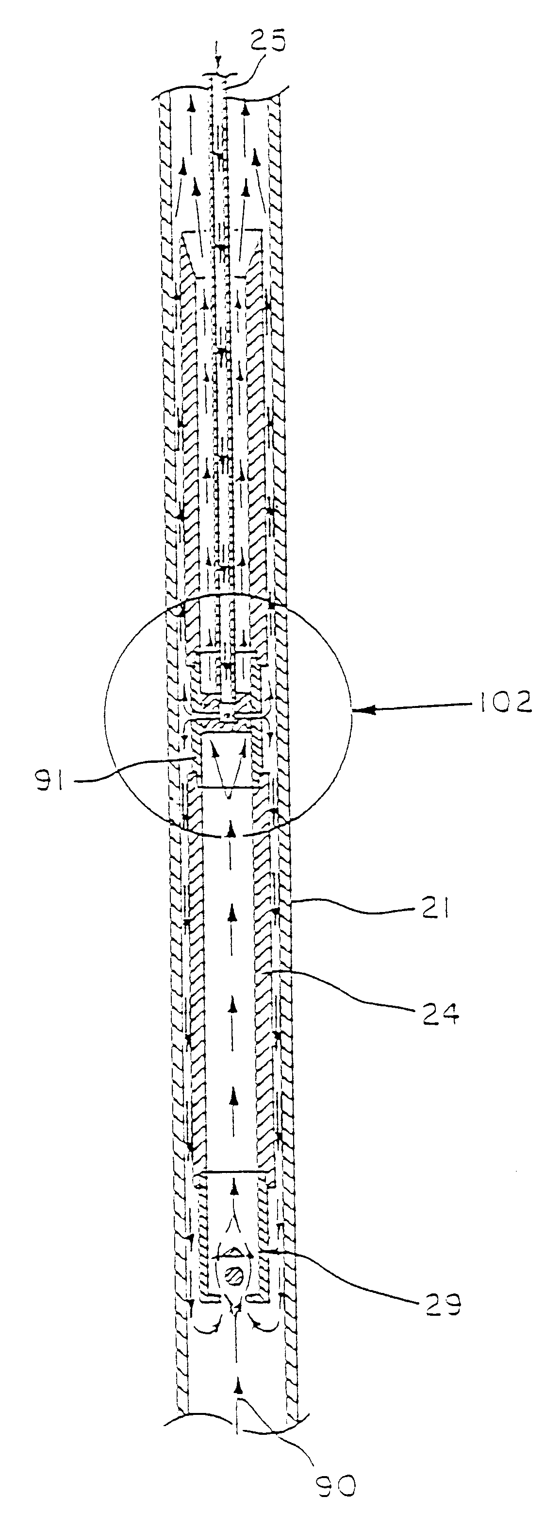 Pump systems and methods