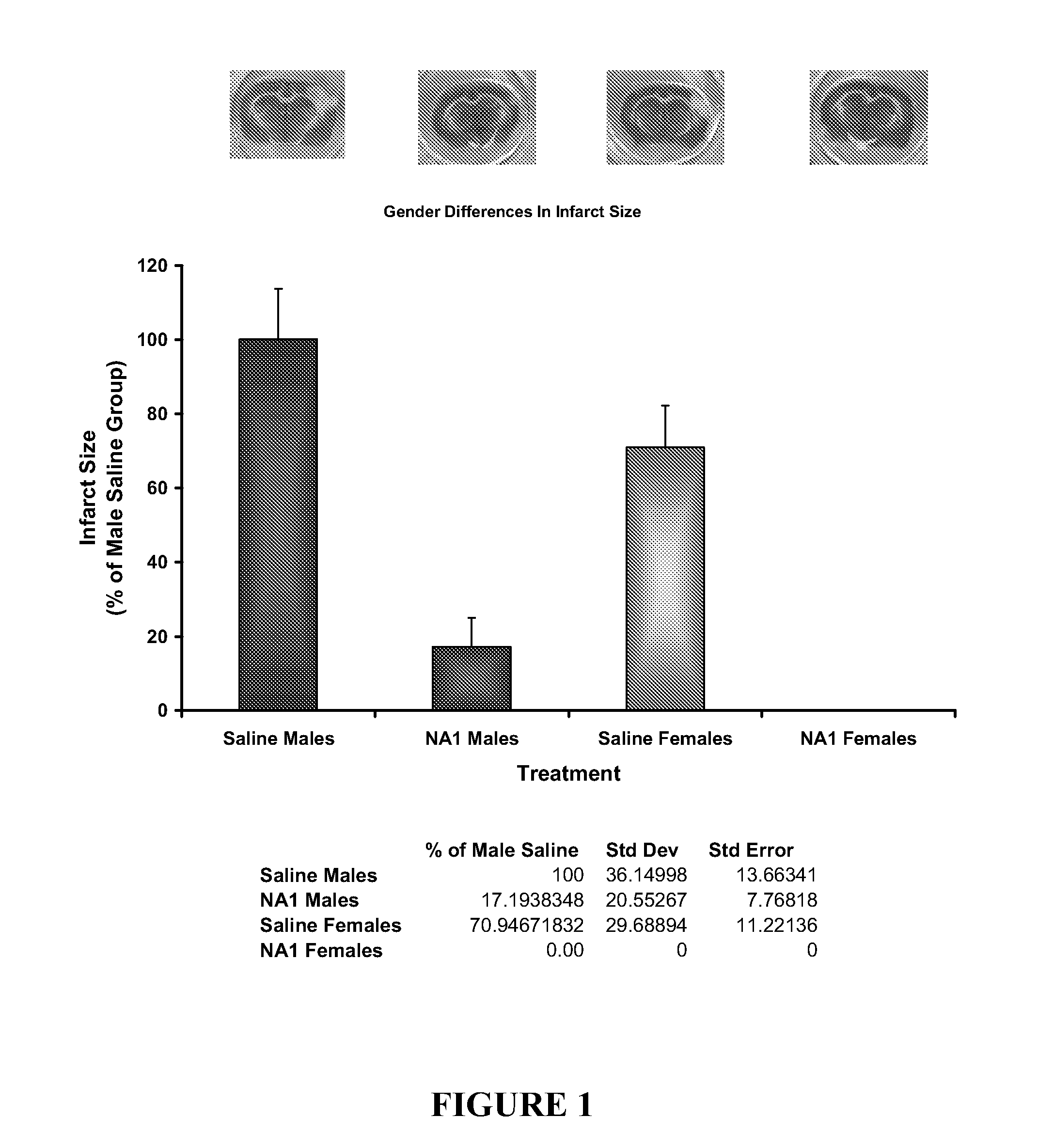 Co-administration of an agent linked to an internalization peptide with an anti-inflammatory