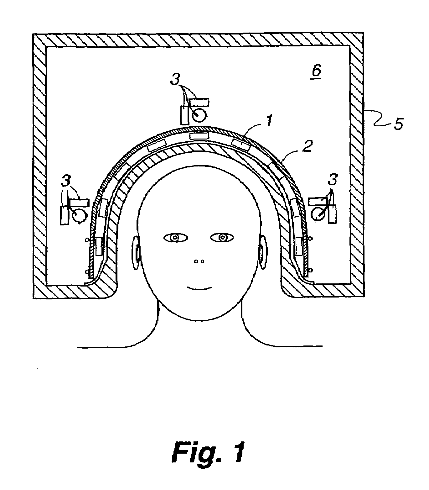 Noise cancellation in magnetoencephalography and electroencephalography with isolated reference sensors