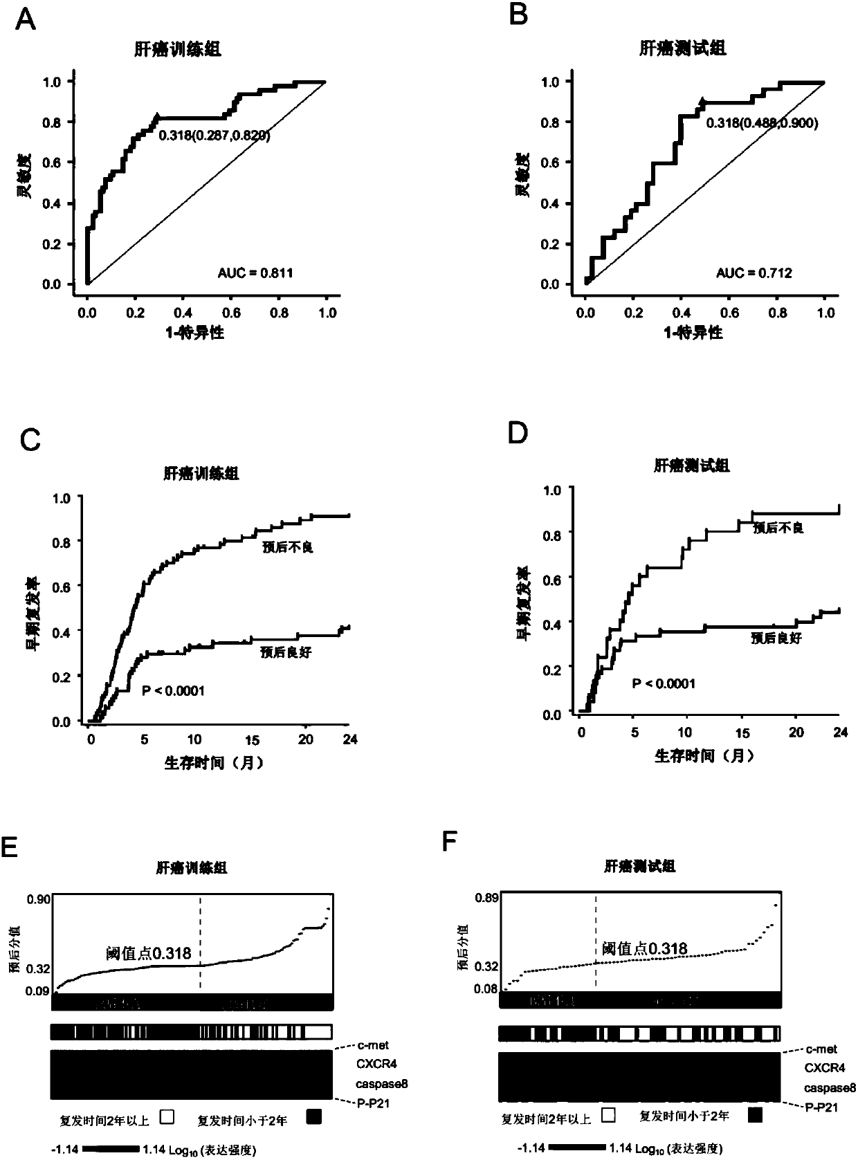 System used for predicting prognosis of liver cancer patient