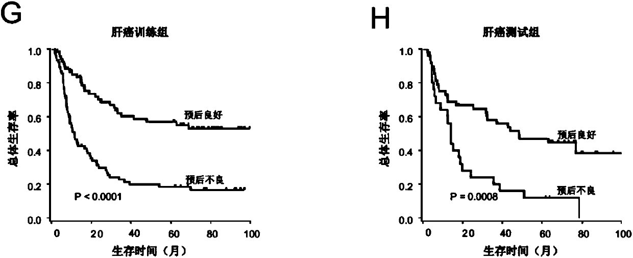 System used for predicting prognosis of liver cancer patient