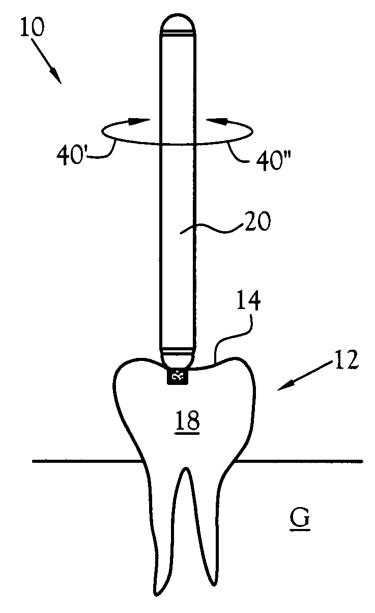 Universal depth cut burr having dental and skeletal applications