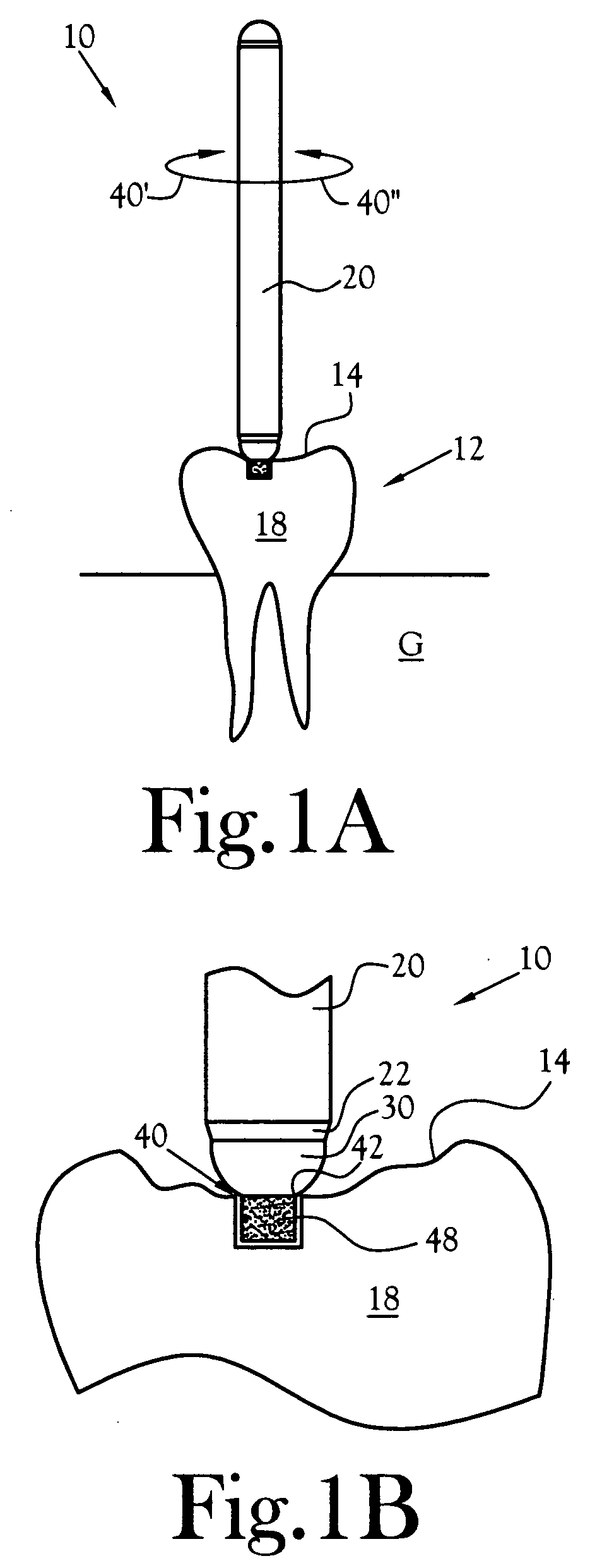 Universal depth cut burr having dental and skeletal applications