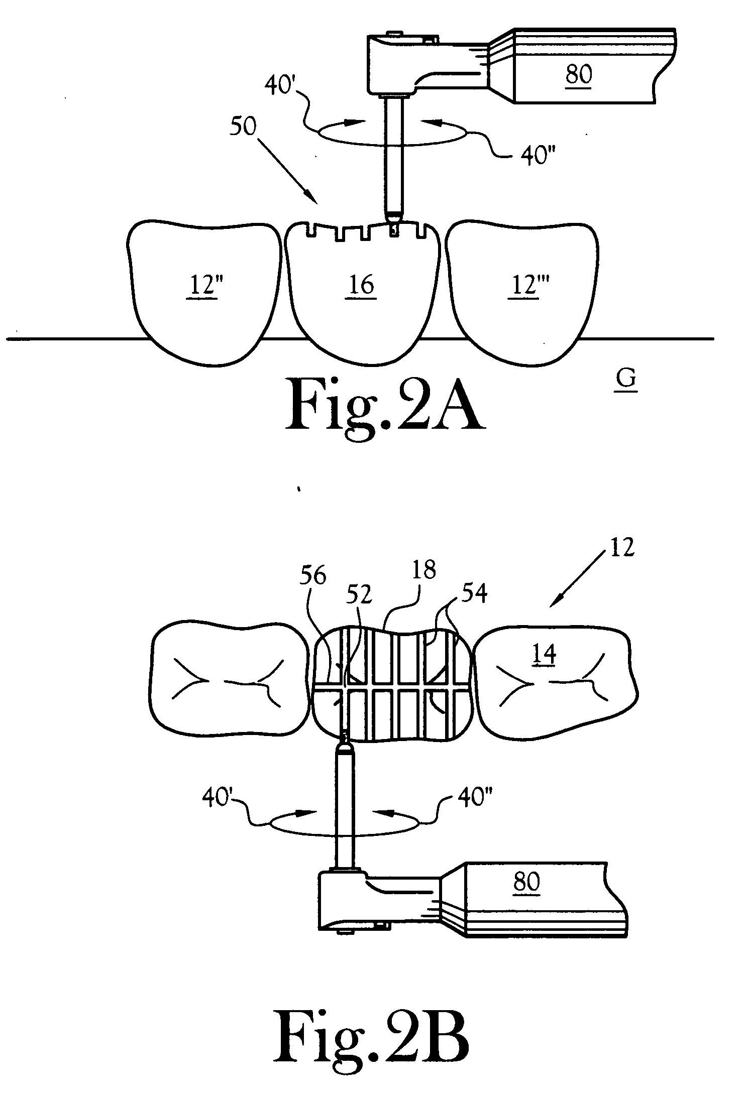 Universal depth cut burr having dental and skeletal applications