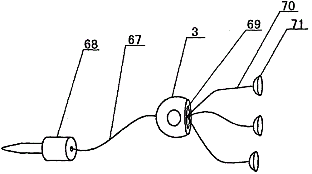 Anesthesia monitoring control device for orthopedic department