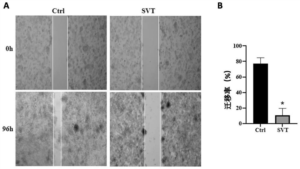 Application of simvastatin in preparation of medicine for preventing or treating liver cancer