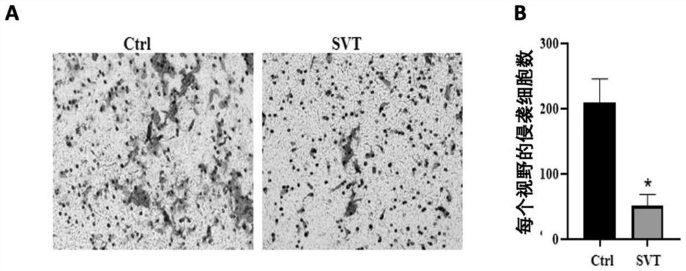 Application of simvastatin in preparation of medicine for preventing or treating liver cancer