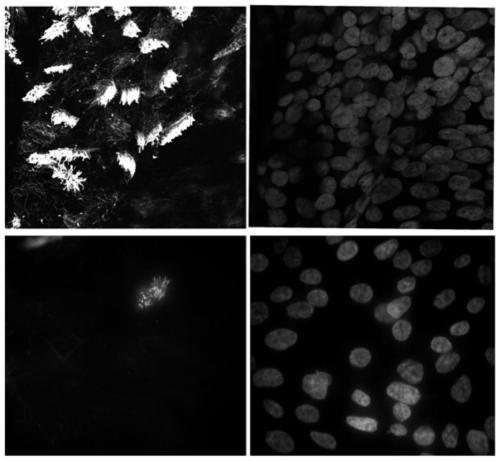 Culture method of human fallopian tube epithelial cells