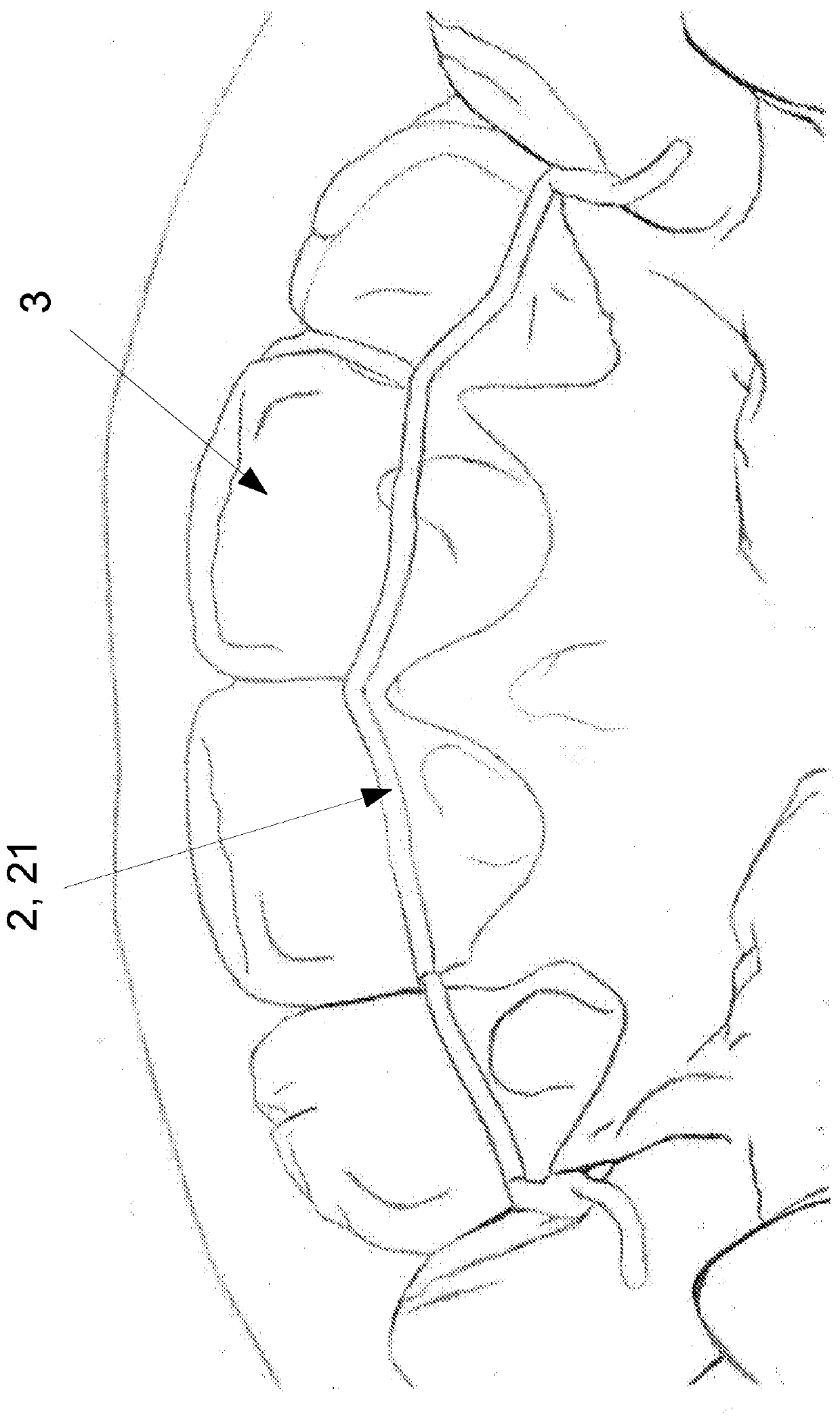 Three-dimensional orthodontic retainer and method for producing a three-dimensional orthodontic retainer