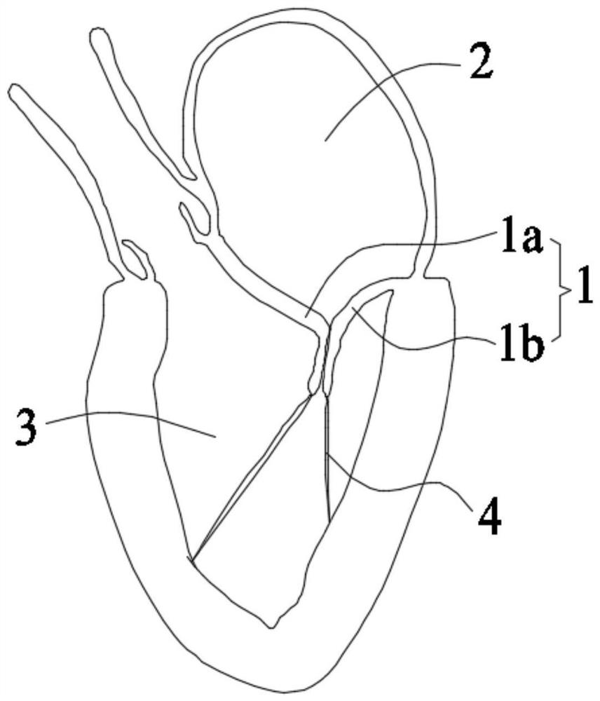 Anti-slip valve clamping device and valve clamping system