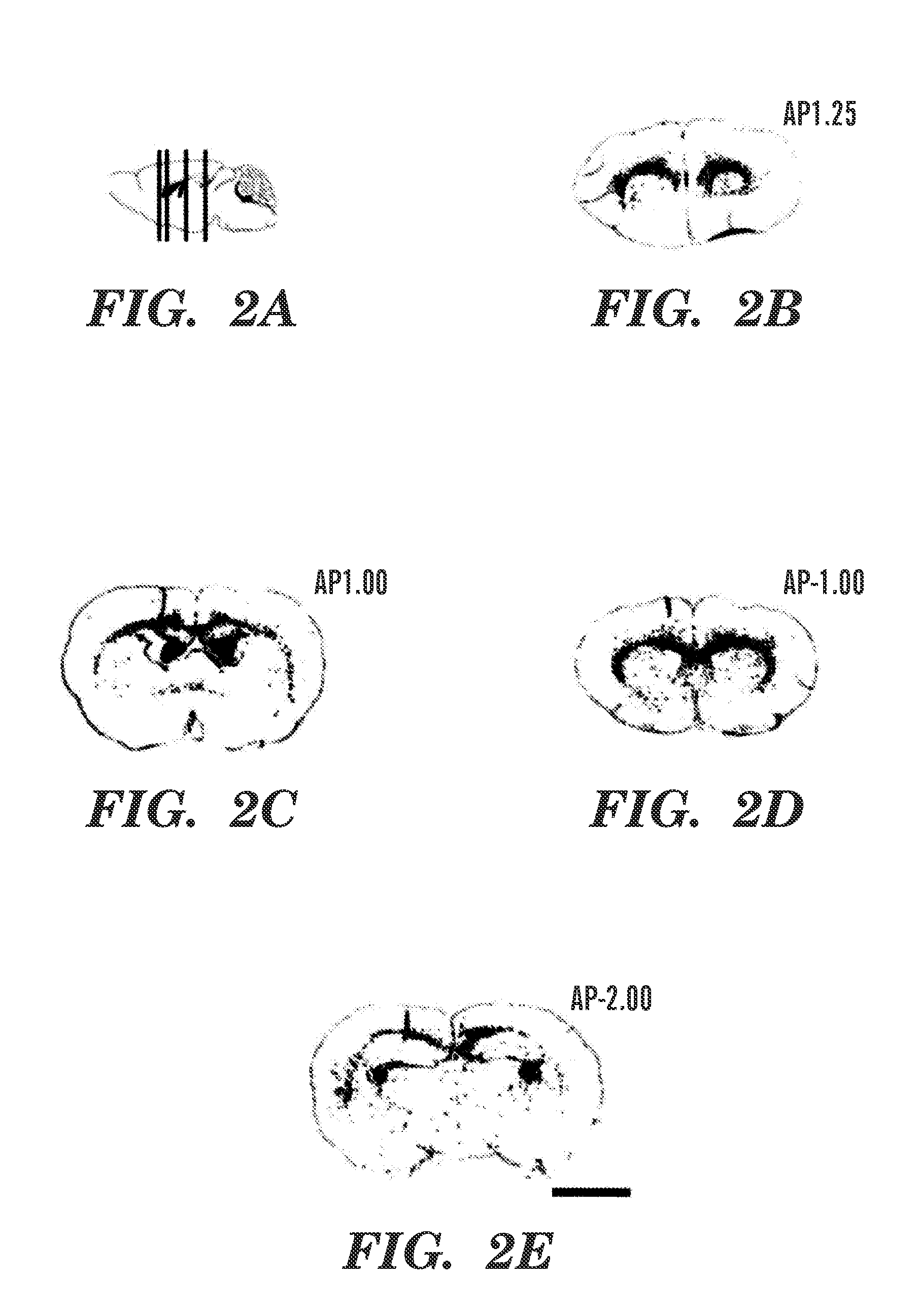 Myelination of congenitally dysmyelinated forebrains using oligodendrocyte progenitor cells