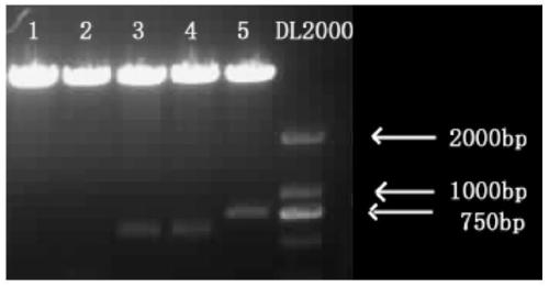 Application of small molecule peptide nfib