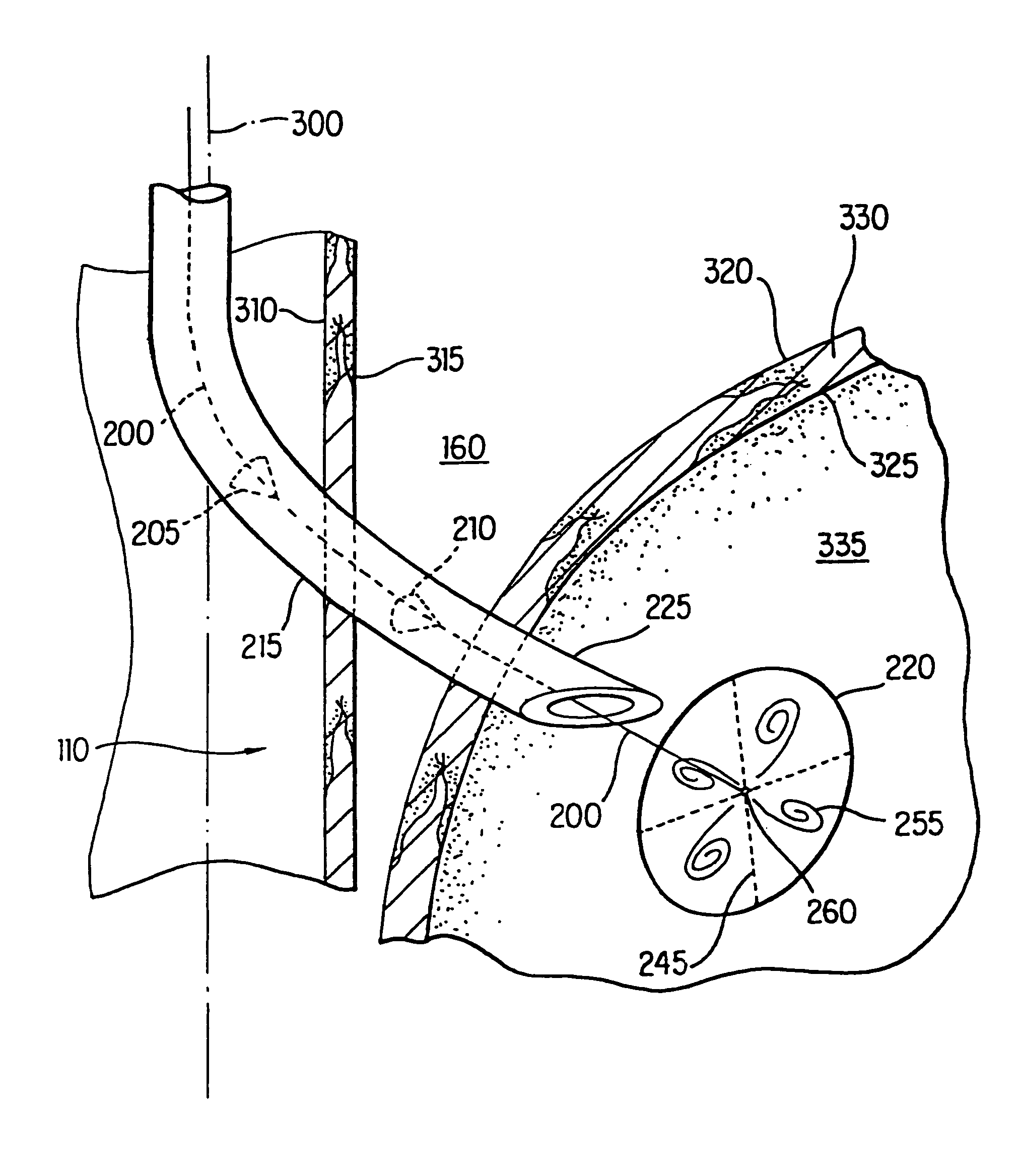 Apparatus for endoscopic repair of the lower esophageal sphincter