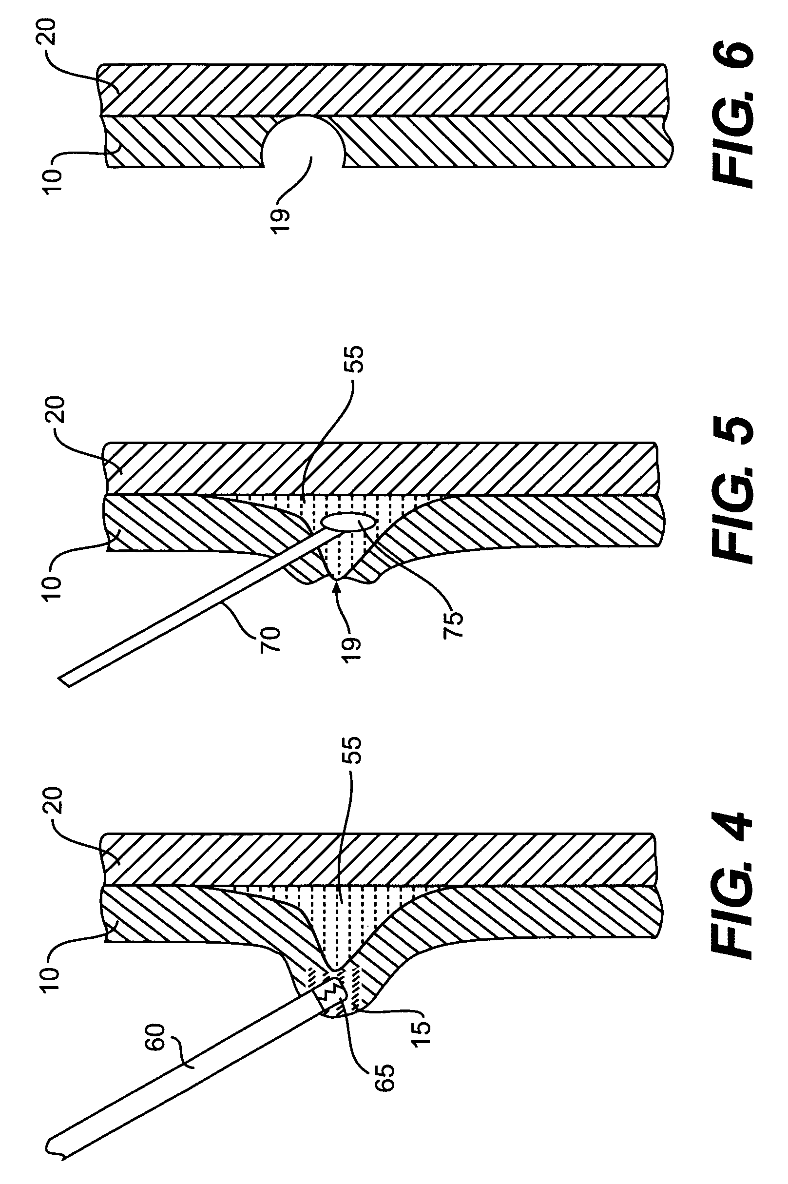 Devices and methods for agent-assisted medical procedures