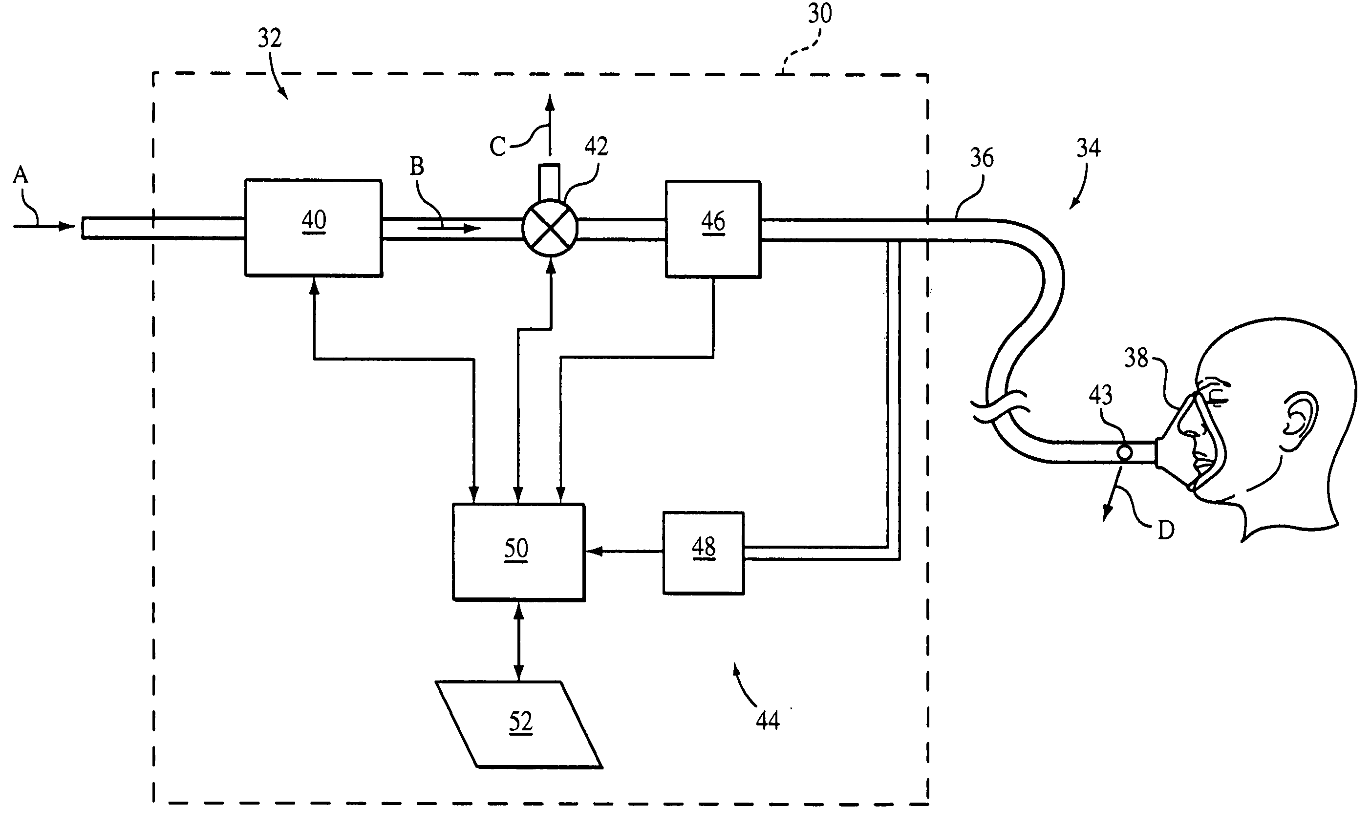 Auto-titration pressure support system and method of using same