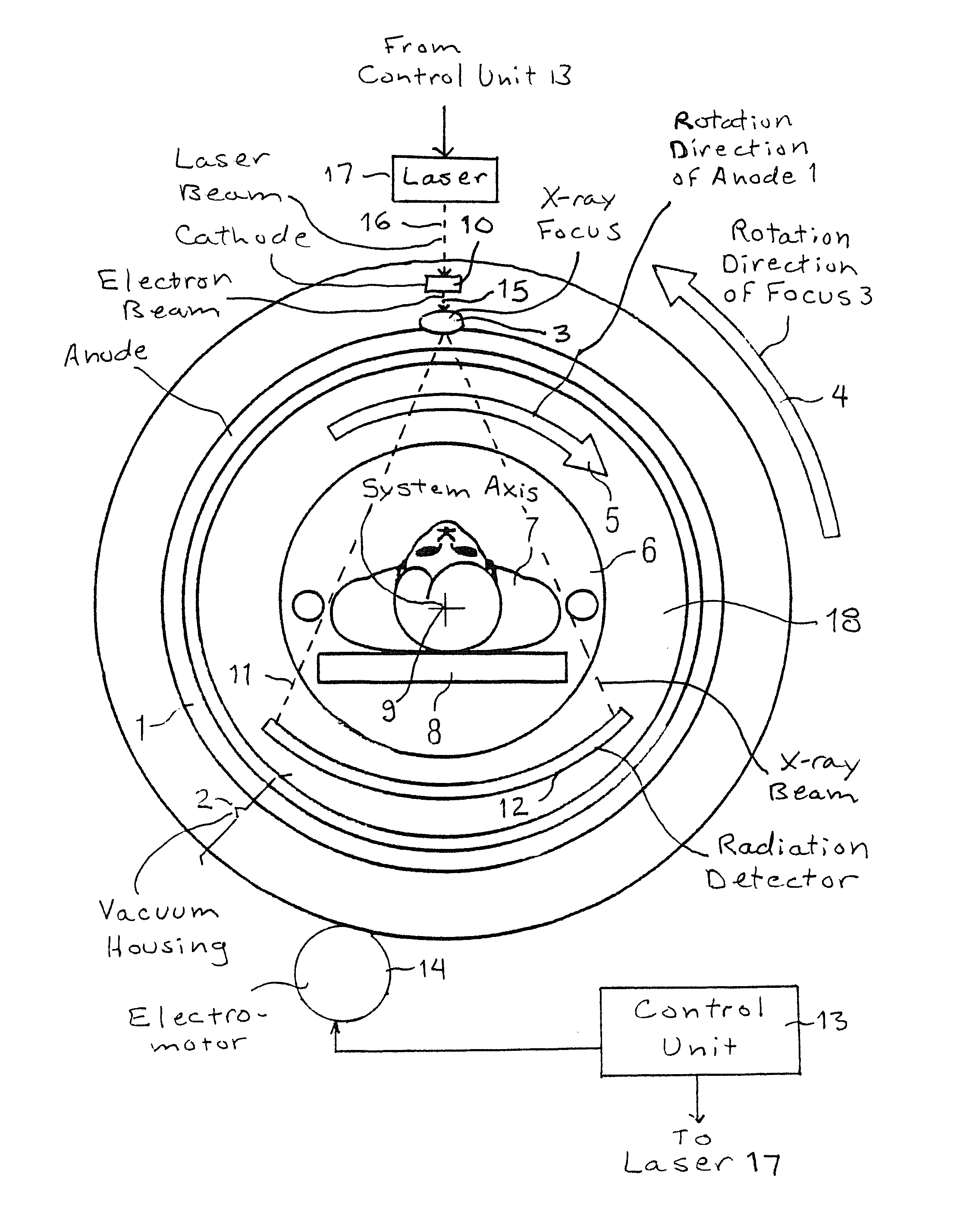 X-ray CT system having a patient-surrounding, rotatable anode with an oppositely rotatable x-ray focus