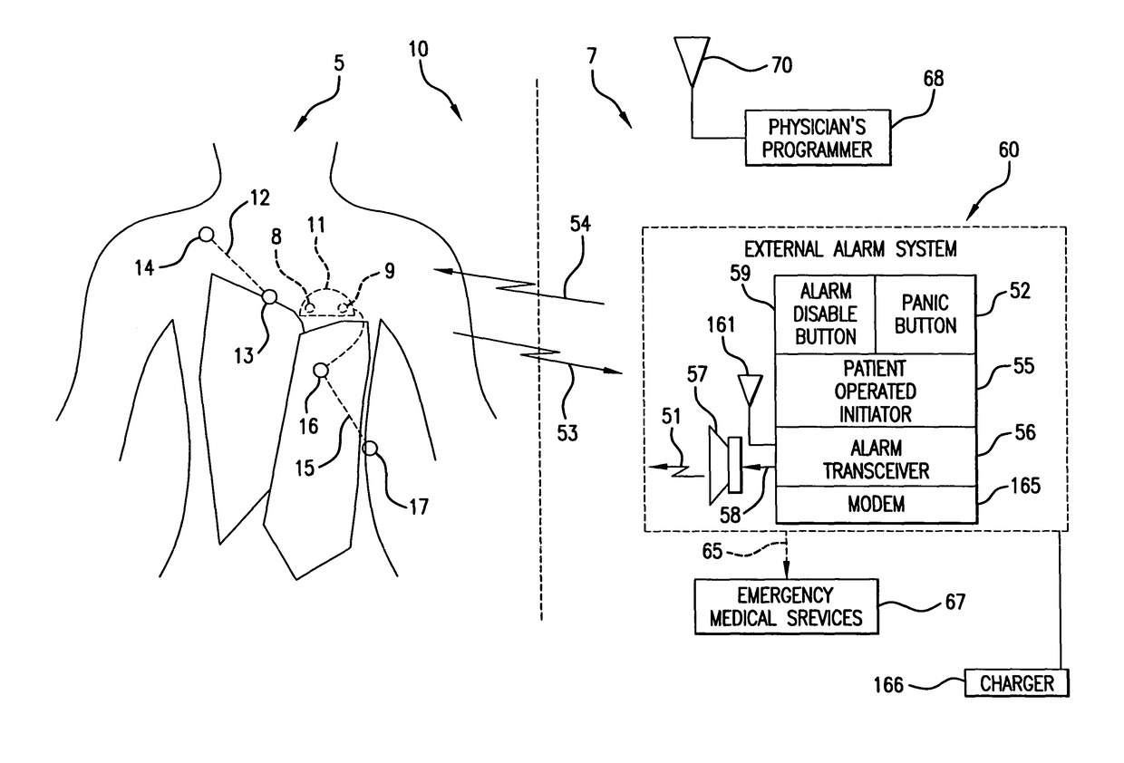 Waveform feature value averaging system and methods for the detection of cardiac events