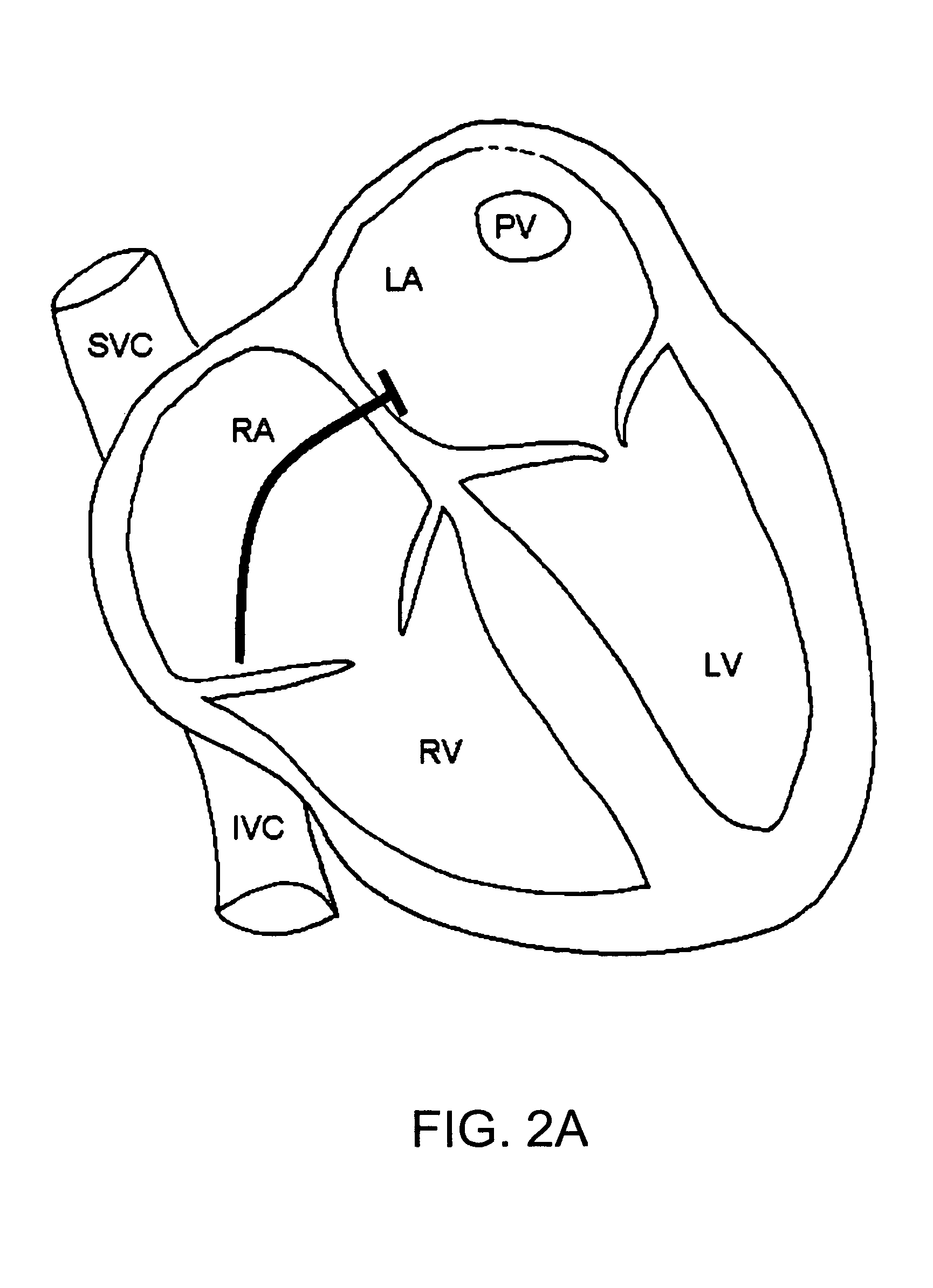 Methods and devices for image-guided manipulation or sensing of anatomic structures