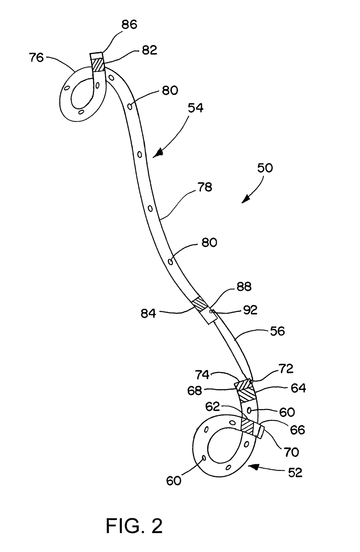 Ureteral stent for placement in a kidney and bladder