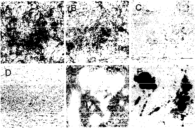 Method for in-vitro liver cell differentiation of human marrow mesenchyme stem cells based on VPA inducement