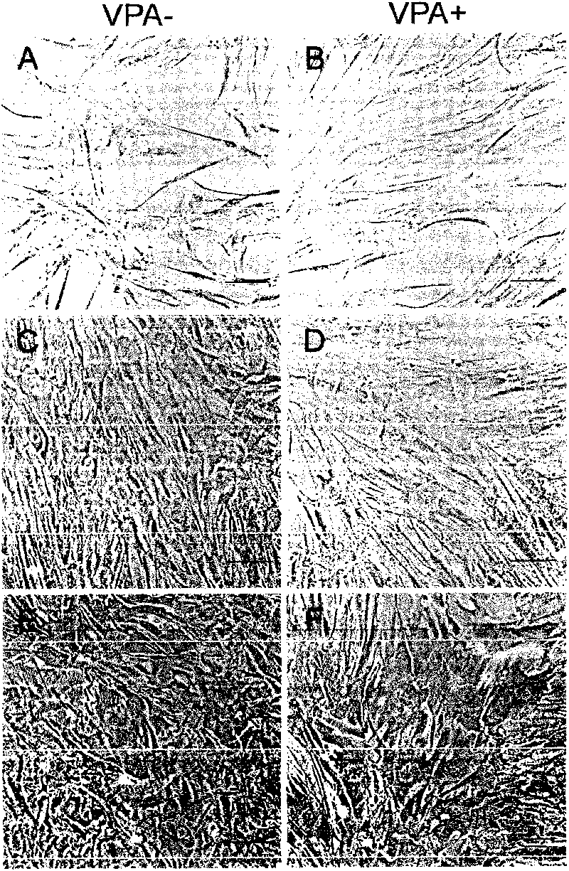 Method for in-vitro liver cell differentiation of human marrow mesenchyme stem cells based on VPA inducement