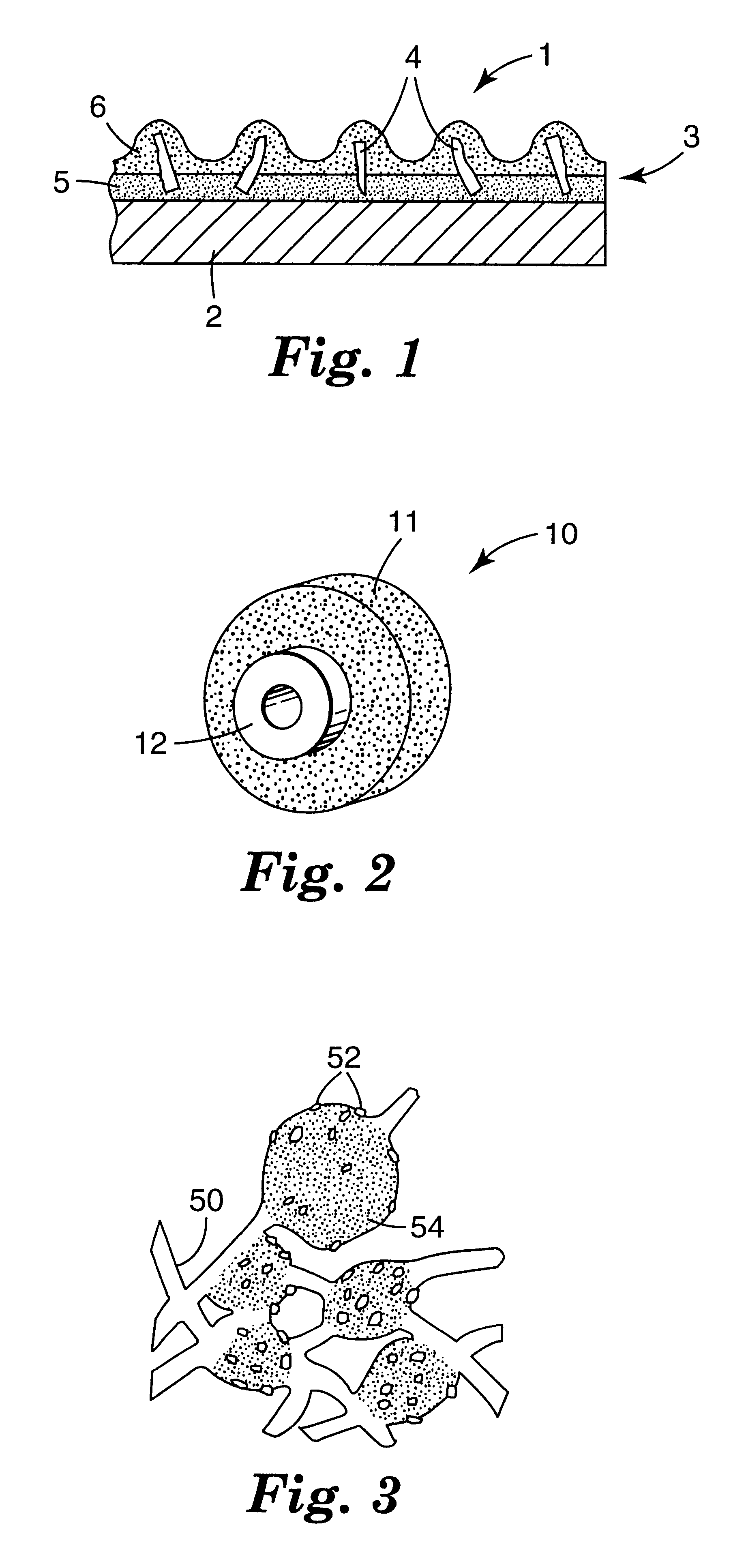 Fused AL2O3-rare earth oxide-ZrO2 eutectic abrasive particles, abrasive articles, and methods of making and using the same