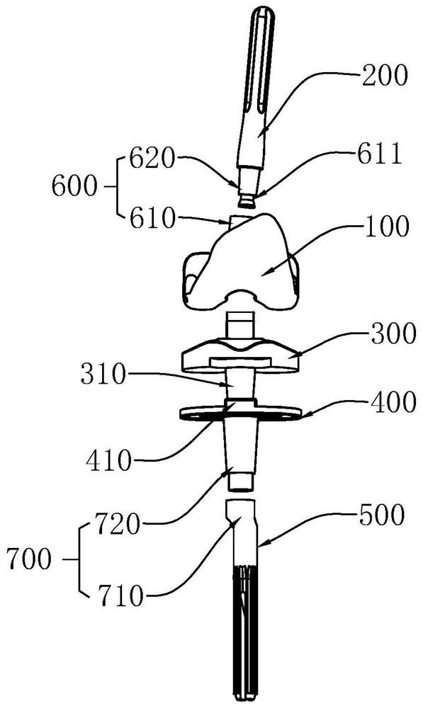 Tantalum metal bone trabecula femoral condyle prosthesis and knee joint replacement body