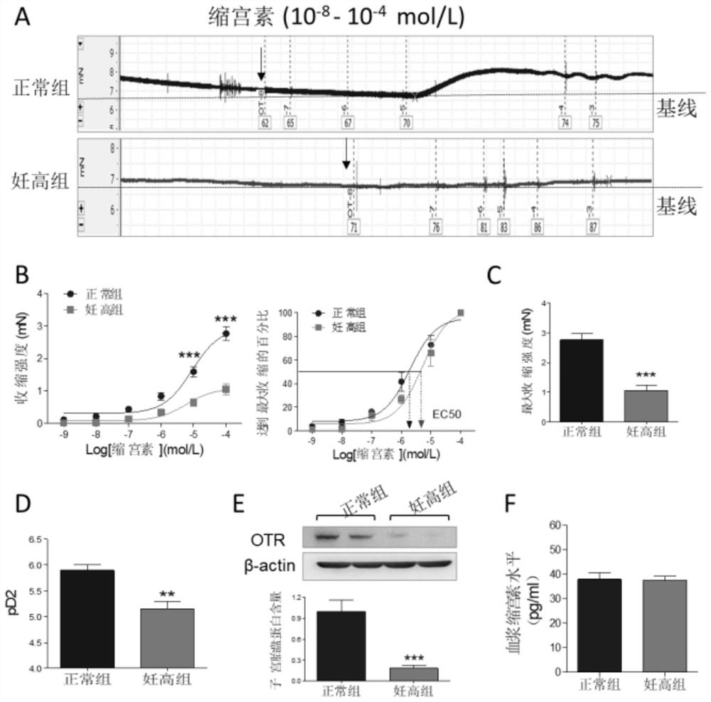 Clinical application of oxytocin injection to pregnant women with hypertension