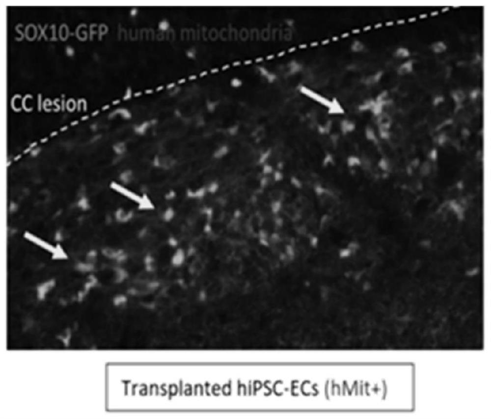 Application of endothelial cells and precursor cells thereof in treatment of demyelination diseases