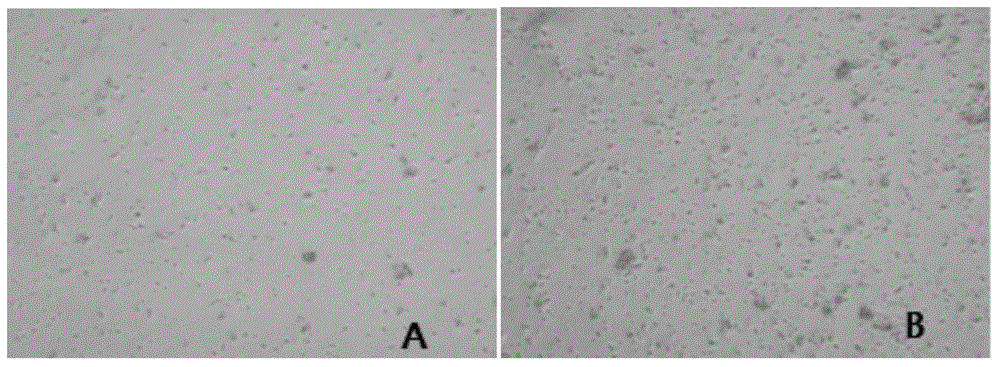 Primary isolation culture method of adipose-derived stem cells